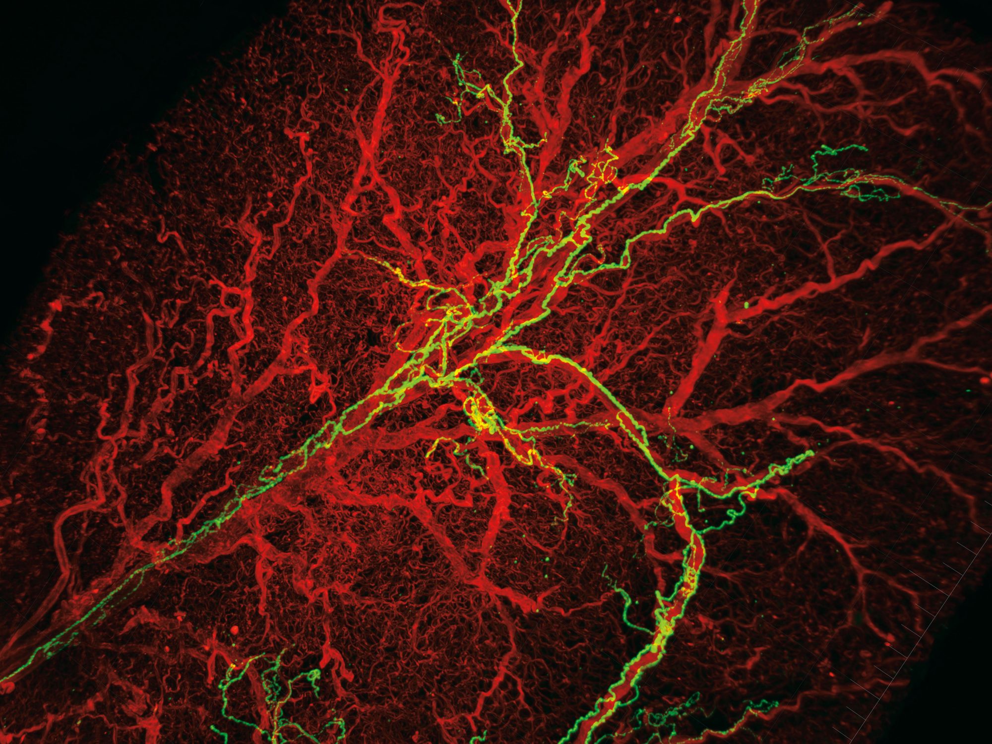 Inside the energy-burning cells that just might hold the answer of some of our biggest health problems.