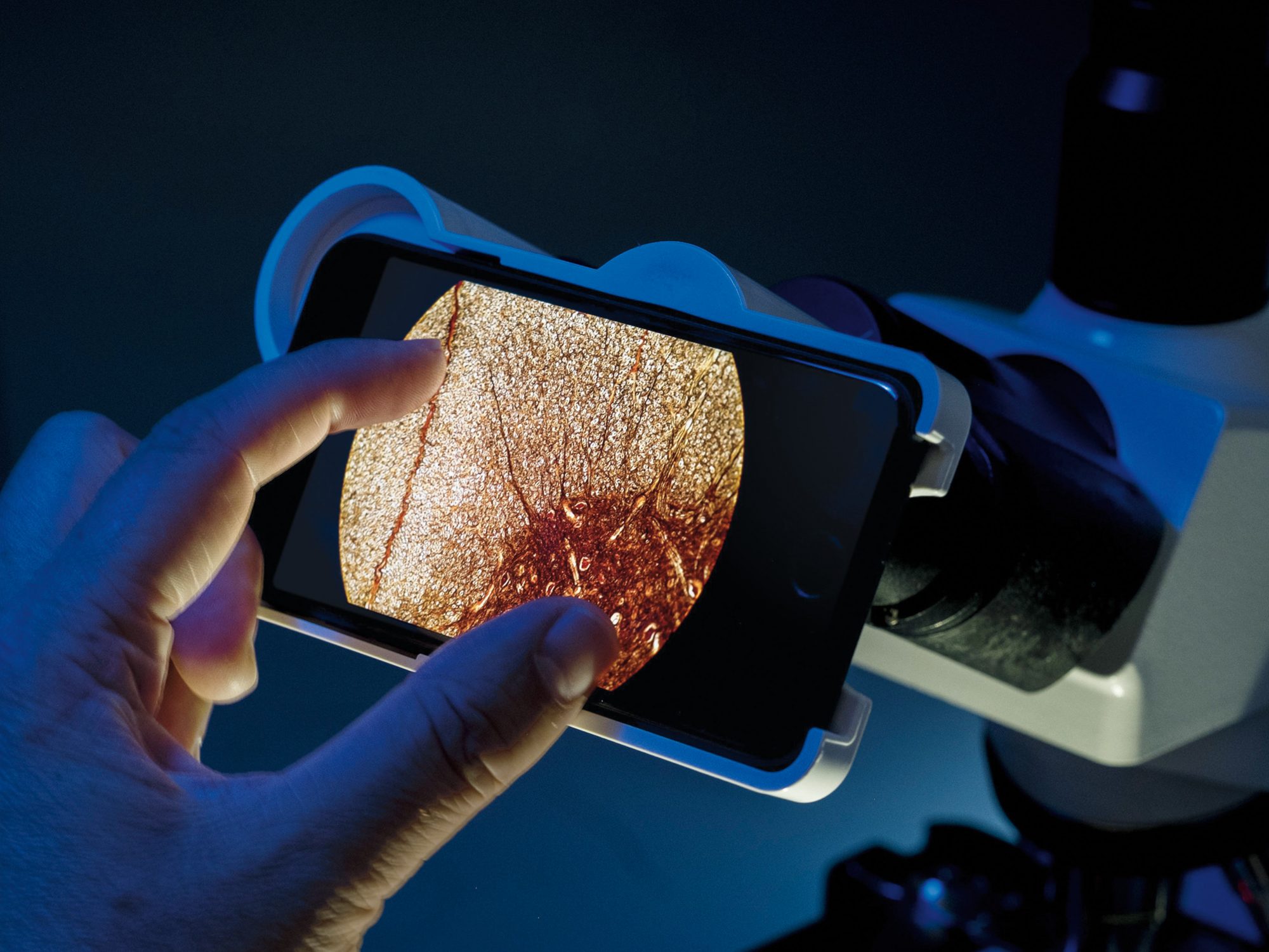Live-cell imaging in your pocket