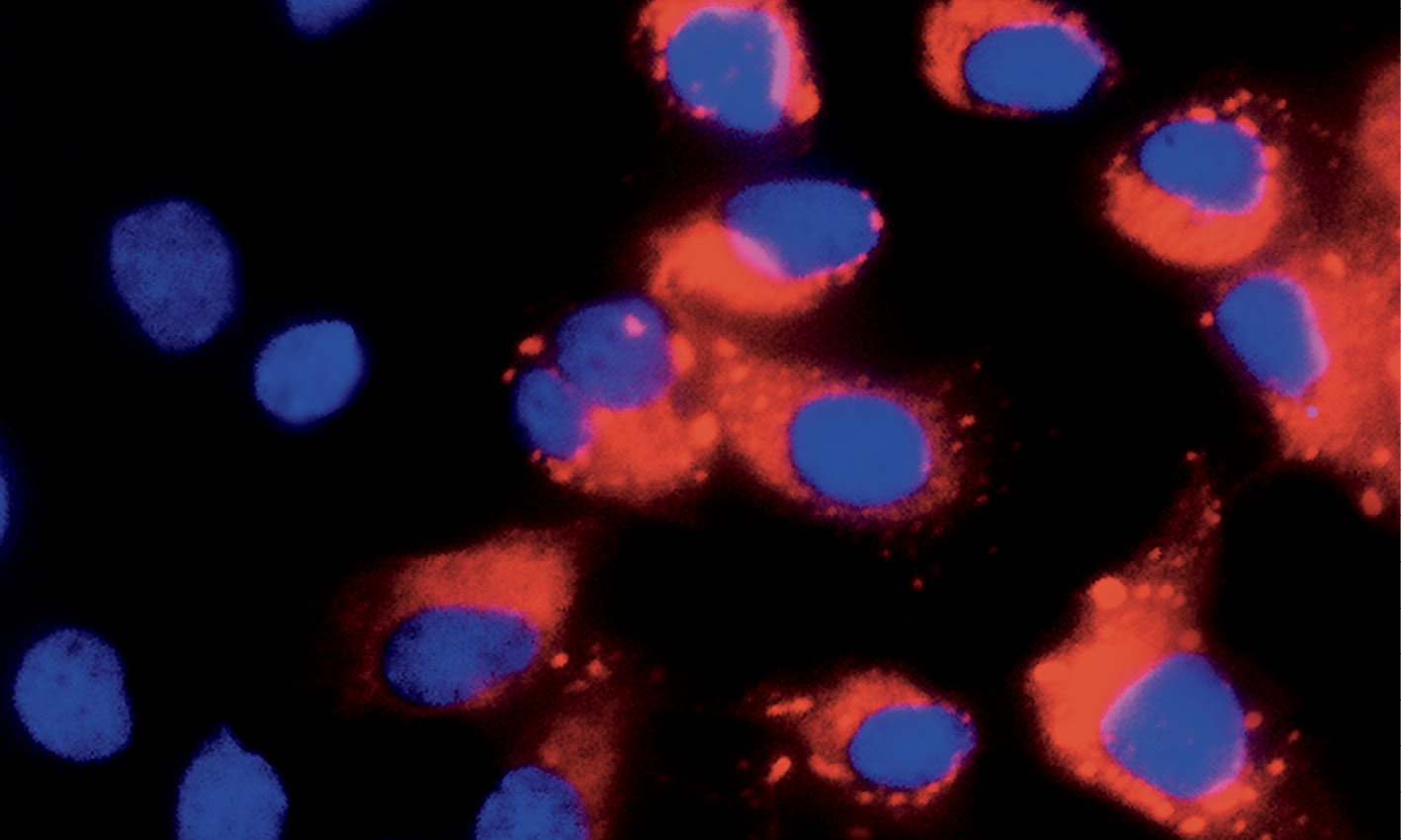 Stem cells lacking protective genes are vulnerable to attack by viruses such as dengue (red).