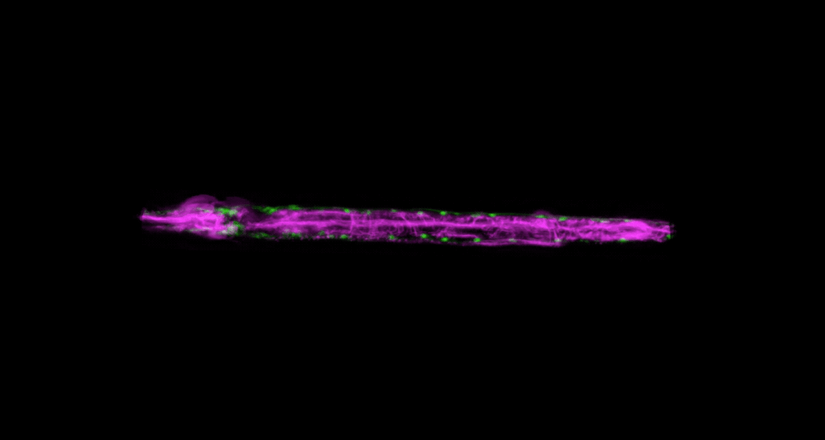 Developing neurons (magenta) imaged over 24 hours in a growing worm.