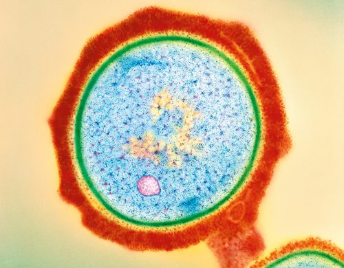A new drug kills antibiotic-resistant bacteria by destroying their cell walls (green).
