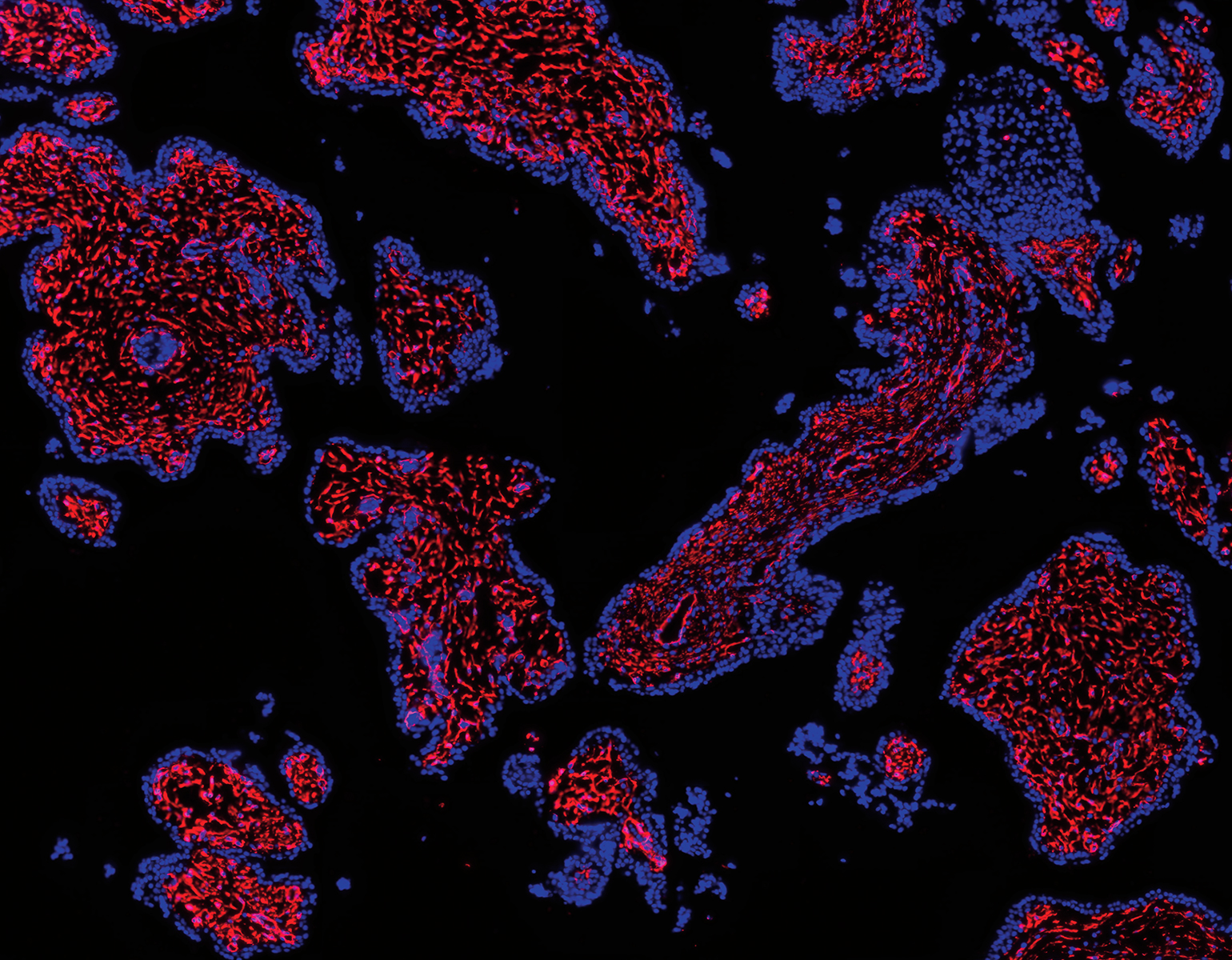 Stromal and endothelial cells of the plancenta, in red.