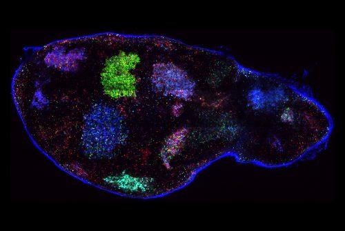 Activated B cells cluster in germinal centers (blue, green, and purple) inside a mouse lymph node.