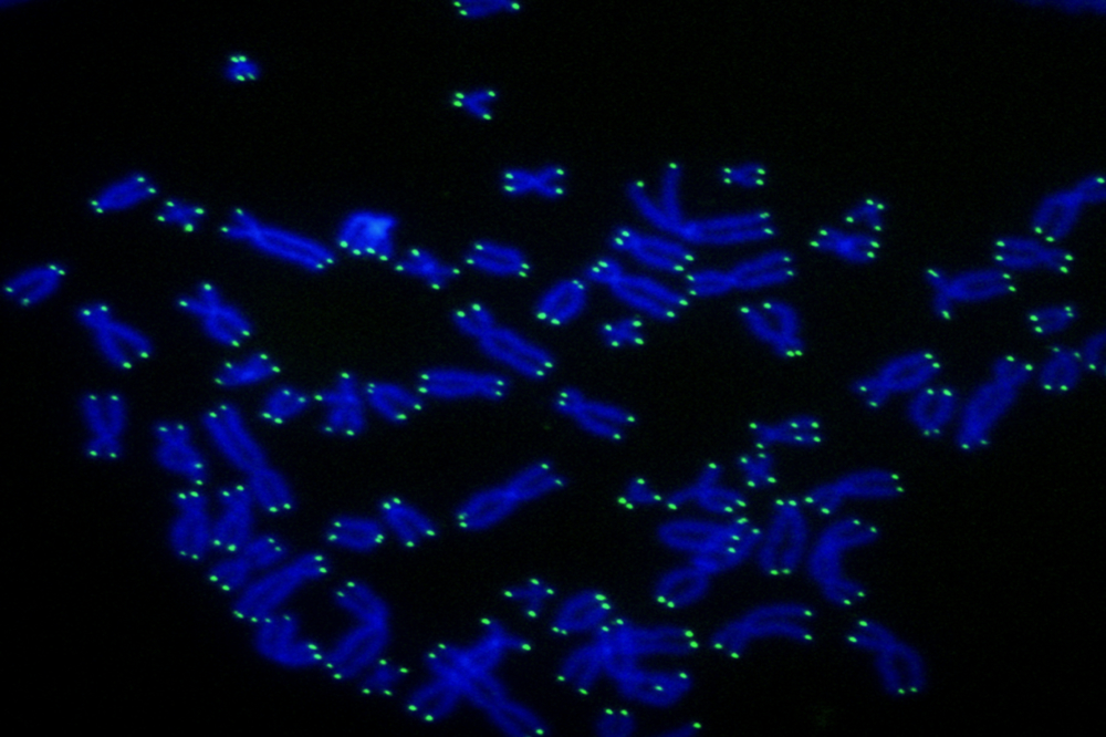 Human telomeres (green) at the ends of chromosomes (blue).