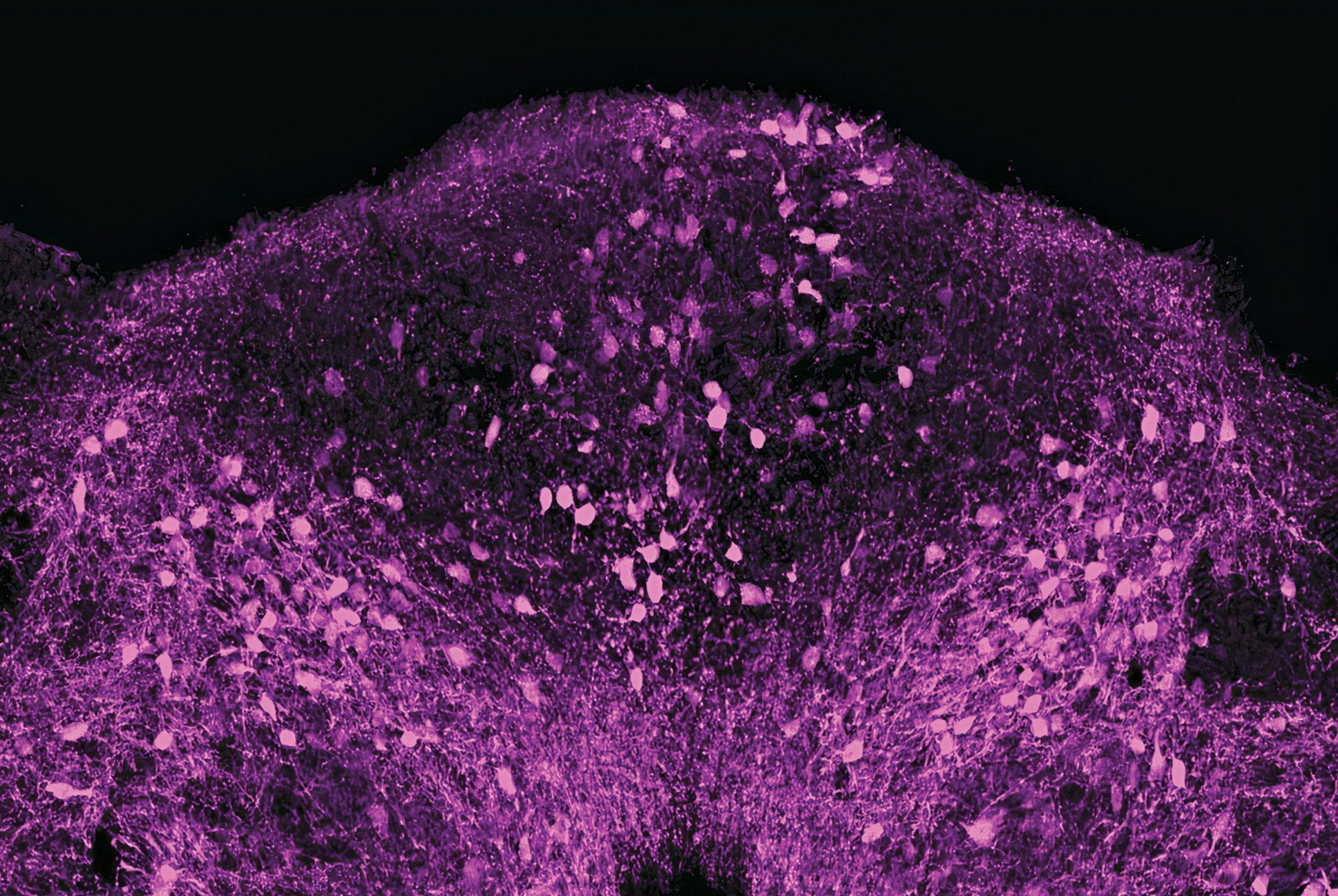 These neurons provide clues to what the brain is up to when the body fights a pathogen.
