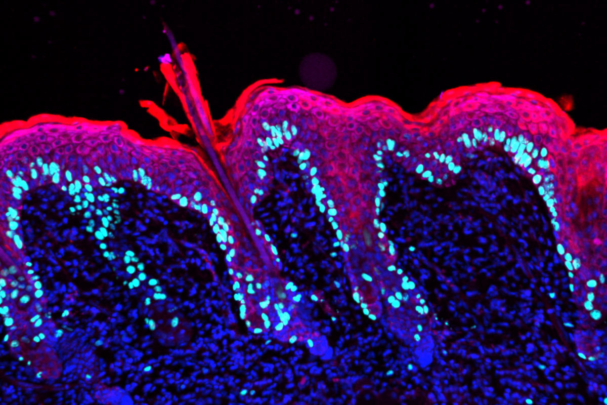 Image from Fuchs’s lab show inflamed skin.