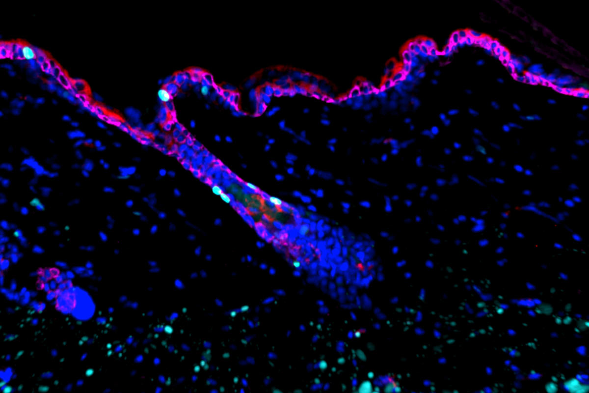 Image from Fuchs’s lab show skin that has undergone inflammatory resolution (below).