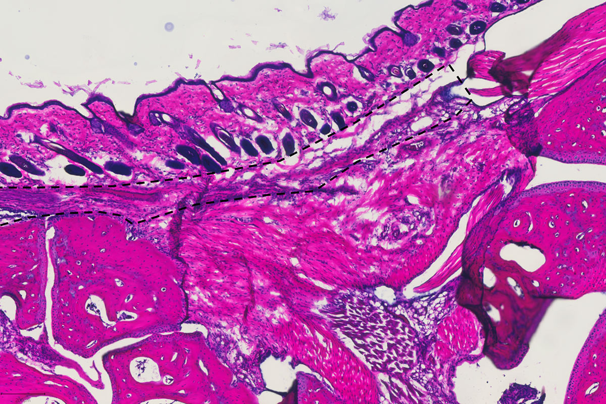 Images from Ravetch’s lab show inflammation of an ankle joint after treatment developed by the researchers.