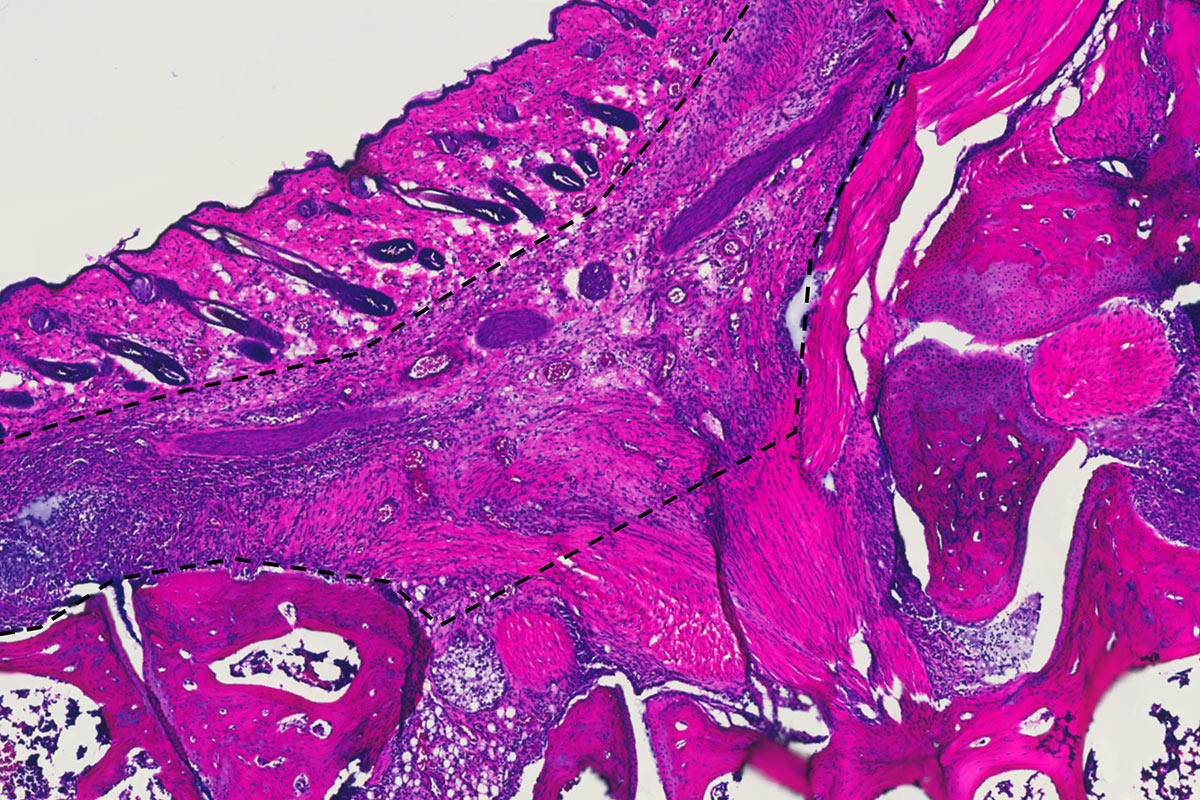 Images from Ravetch’s lab show inflammation of an ankle joint before treatment developed by the researchers.