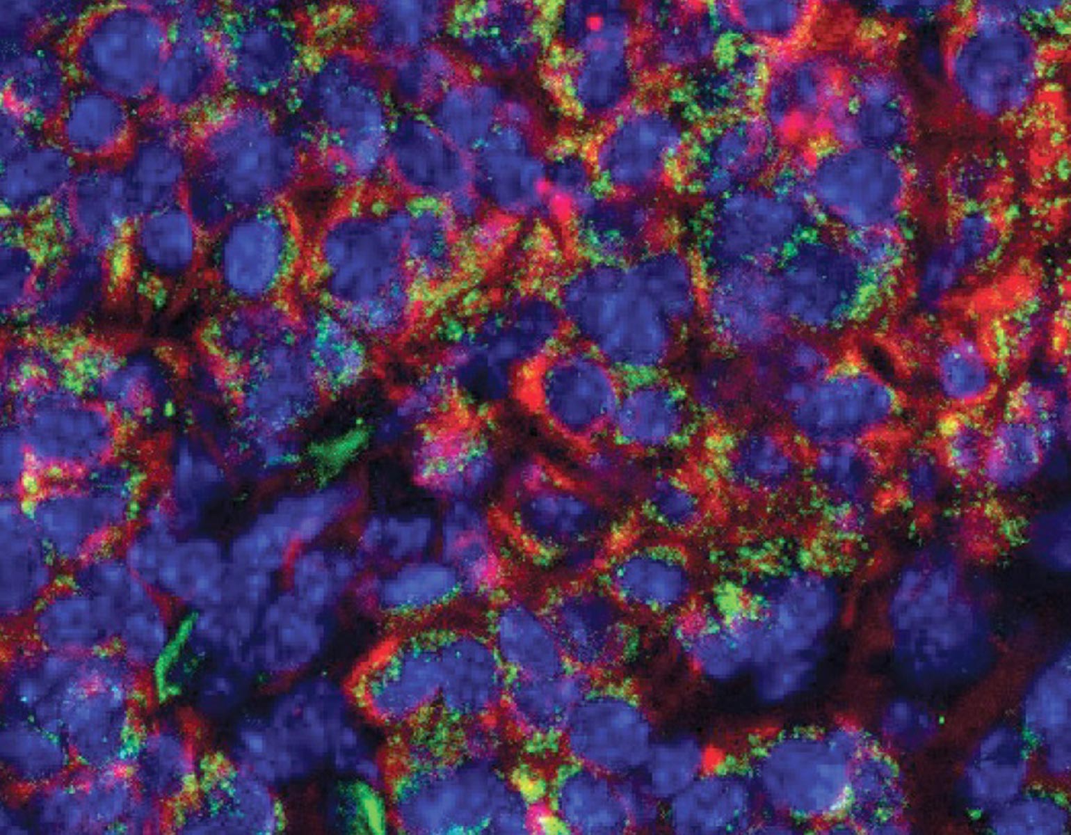 How cancer can use lipids to hide