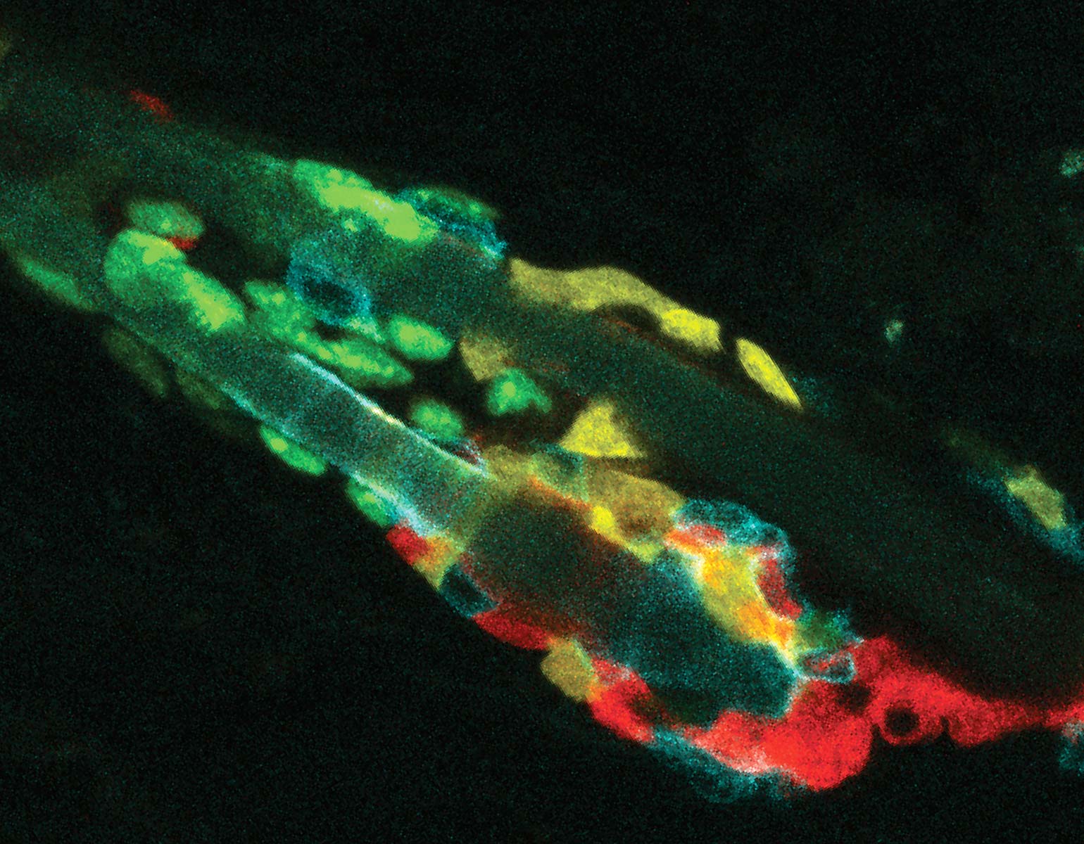 Why cells sometimes eat their neighbors