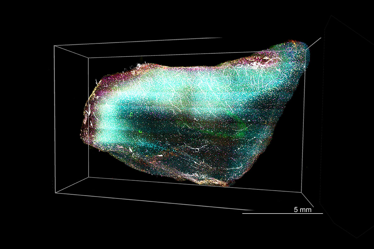 traditional light sheet microscopy