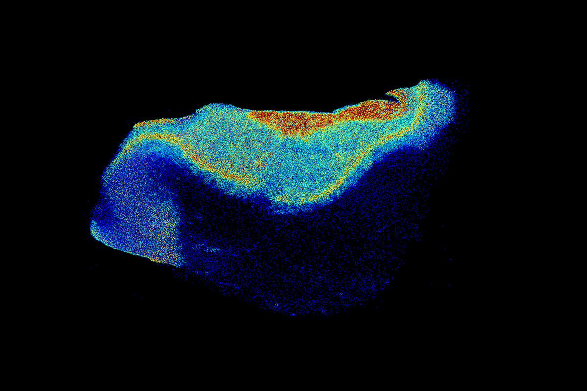 Traditional light sheet microscopy with AI analysis