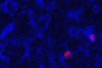 Two small pink spots show infected cells.