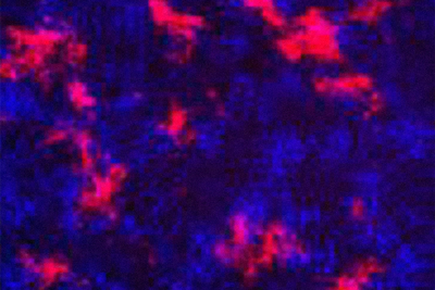 Multiple pink spots on a purple diagram depict infected cells.