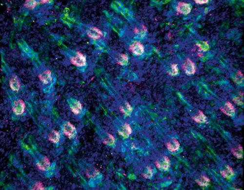 When hair stem cells turn into skin