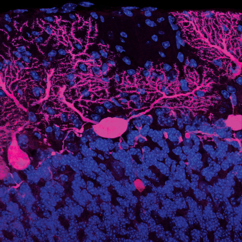 Healthy cerebellum